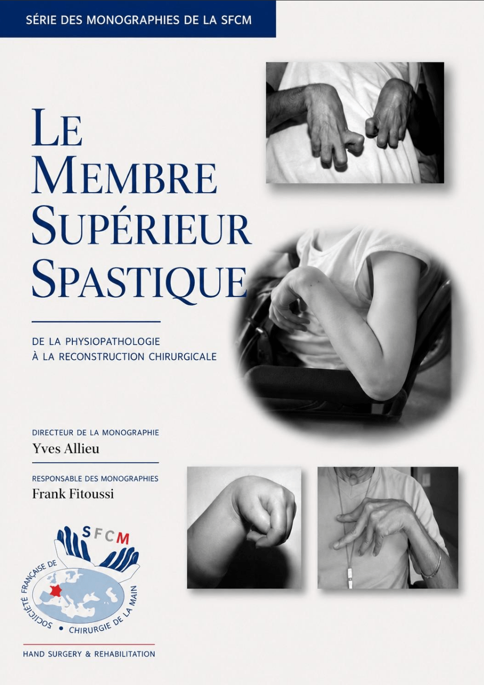 Monographie : Le Membre Supérieur Spastique  - Professeur Y. Allieu